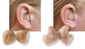 Внутриушные слуховые аппараты (ITE)